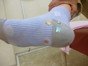 踵の痛み　経過報告